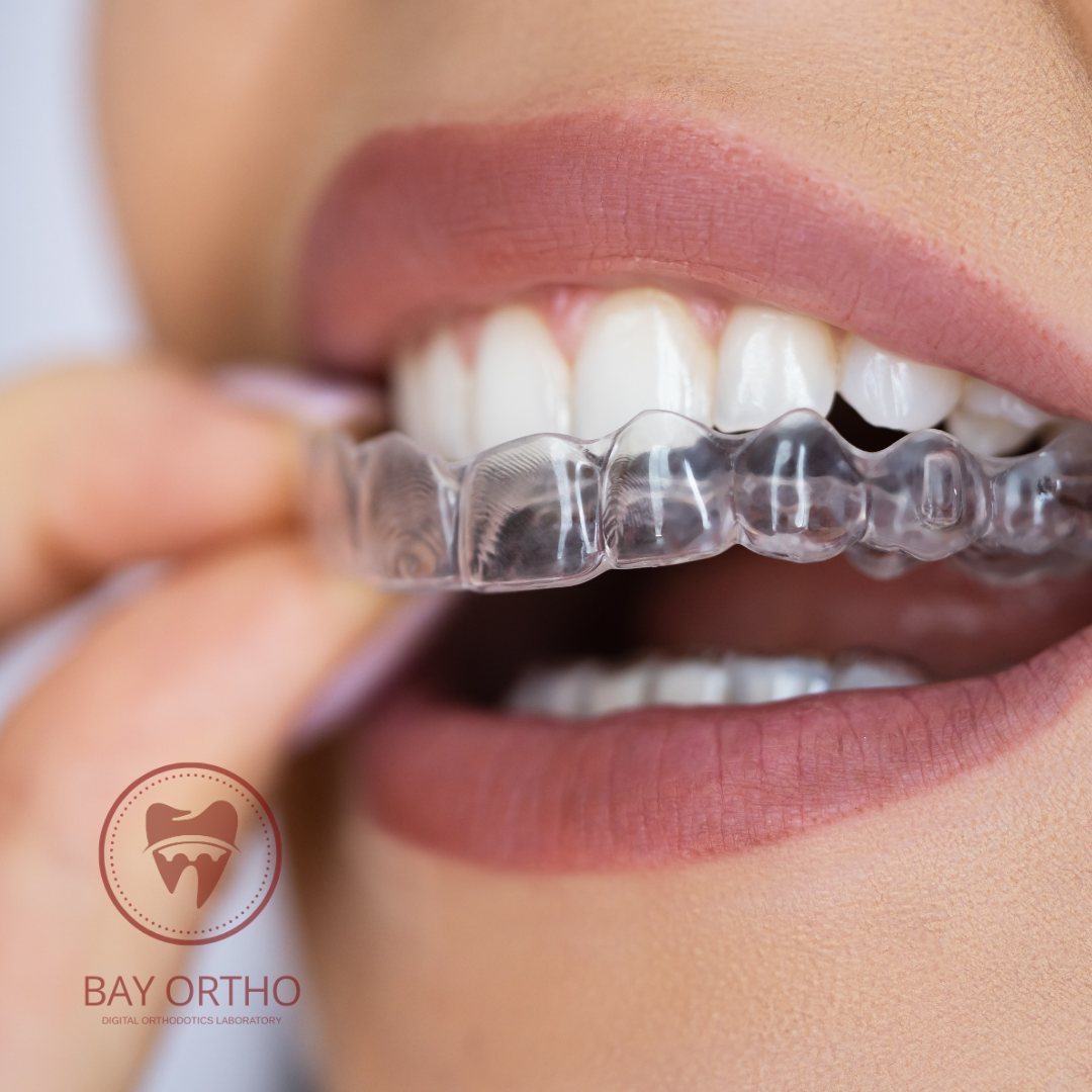 Şeffaf Plak Tedavisi